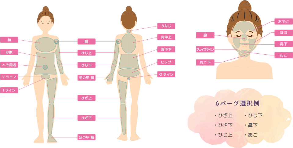 キッズ脱⽑の料⾦と施術範囲